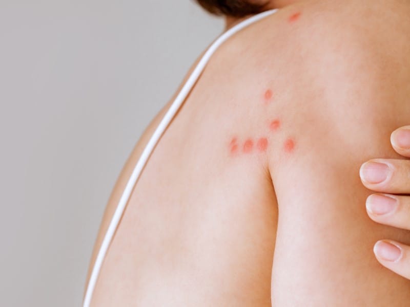 Exterminateur punaise de lit Joliette Lanaudière